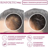 Сыворотка против сильного выпадения волос нанолипосомальная для женщин Pro Rinfoltil/Ринфолтил фл. 30шт