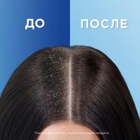 Шампунь и бальзам-ополаскиватель против перхоти 2в1 Основной уход Head&Shoulders/Хэд энд шолдерс900мл миниатюра фото №7