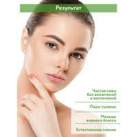Гель очищающий для жирной и проблемной кожи лица Anti-Acne Gel Cleanser Aravia Professional/Аравия 250мл миниатюра фото №3