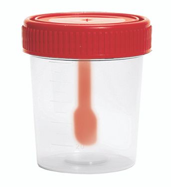 Изображение товара Контейнер для биоматериалов с крышкой и ложкой-шпателем стерильный Клинса 60мл Изображение товара Контейнер для биоматериалов с крышкой и ложкой-шпателем стерильный Клинса 60мл