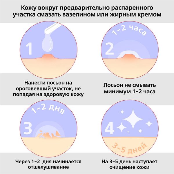 Суперчистотело жидкость для наруж. прим. 3 мл фото №4