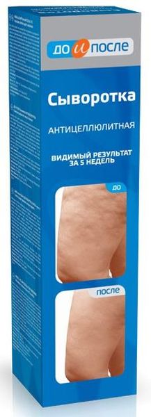 Сыворотка антицеллюлитная До и После 130мл