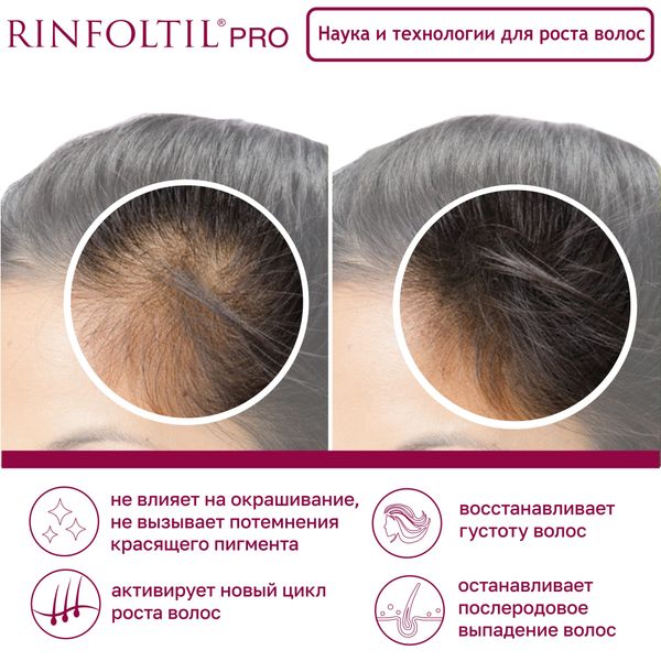Сыворотка против сильного выпадения волос нанолипосомальная для женщин Pro Rinfoltil/Ринфолтил фл. 30шт