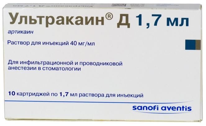 Изображение товара Ультракаин Д раствор для инъекций картридж 40мг/мл 1,7мл 10шт