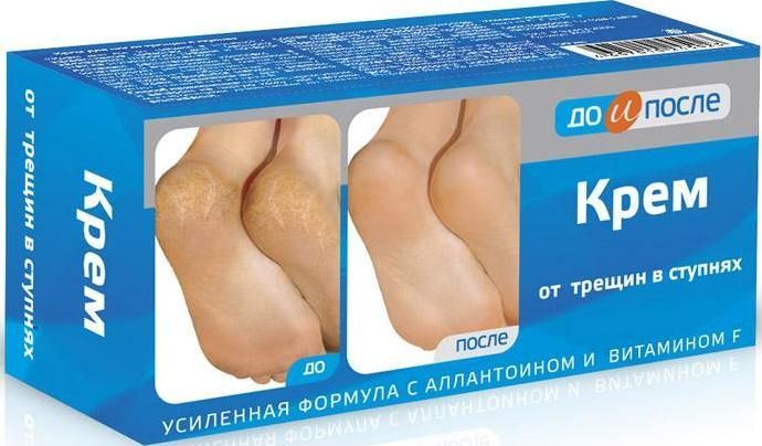 Изображение товара Крем для ног от трещин в ступнях До и после 150мл