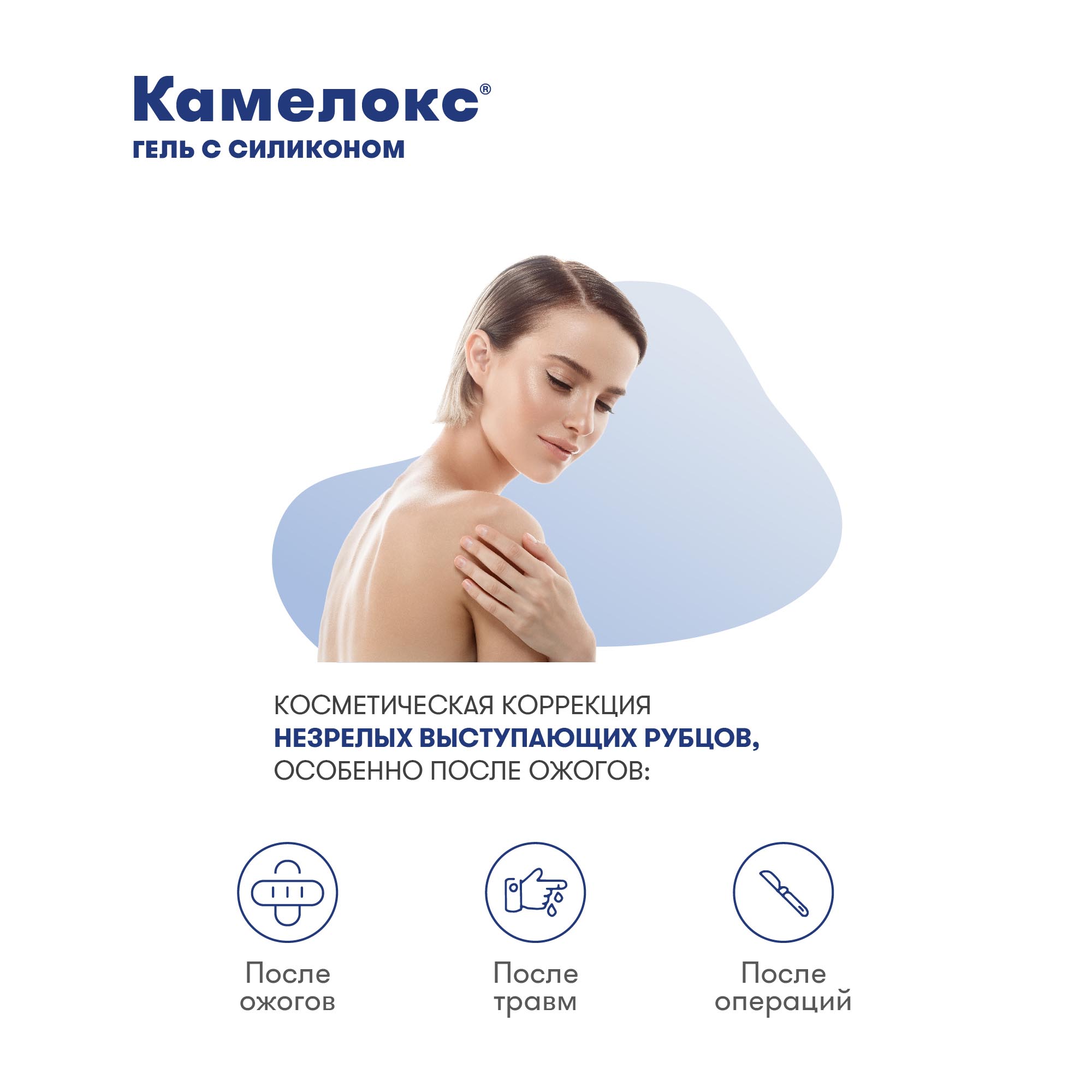 Камелокс Гель Купить В Спб