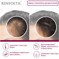 Ринфолтил липосомальная сыворотка против выпадения волос / для ослабленных и источенных 160мг 30шт миниатюра фото №8