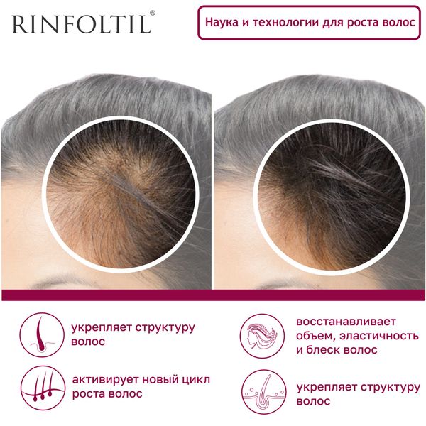 Ринфолтил липосомальная сыворотка против выпадения волос / для ослабленных и источенных 160мг 30шт фото №8