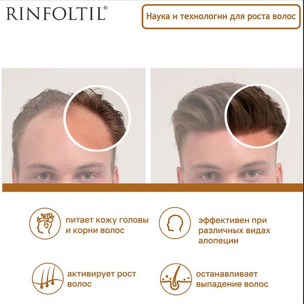Ринфолтил липосомальная сыворотка против выпадения волос/для предотвращения облысения у мужчин 30шт фото №4