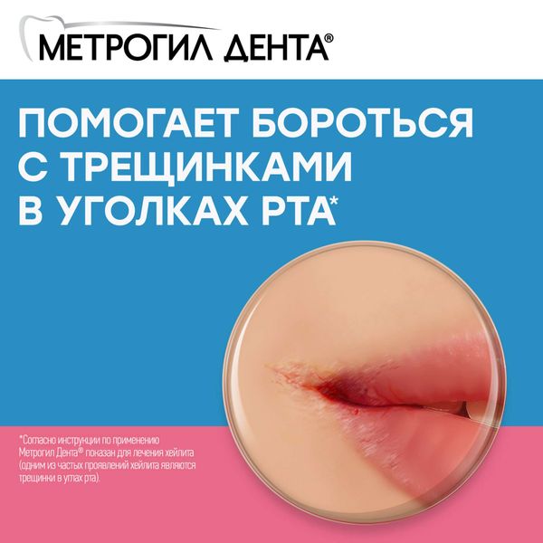 Метрогил Дента гель для десен стоматологический 20г 1шт фото №6
