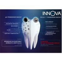 Паста зубная для чувствительных зубов Innova/Иннова Sensitive Бережное осветление эмали 75мл миниатюра фото №6
