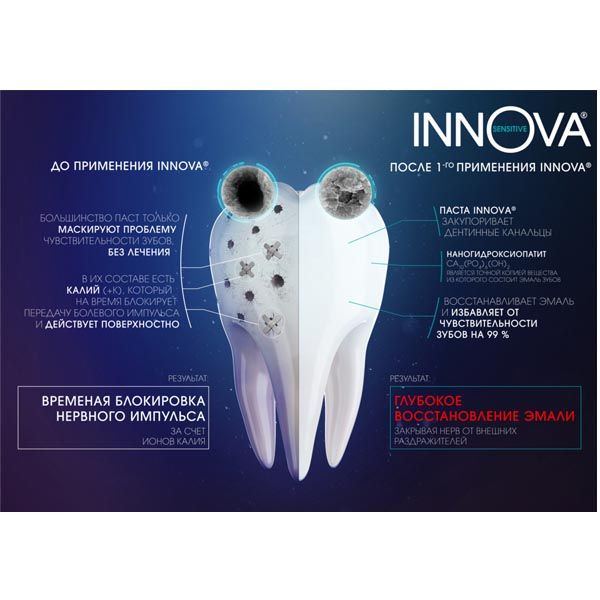 Паста зубная для чувствительных зубов Innova/Иннова Sensitive Бережное осветление эмали 75мл фото №6