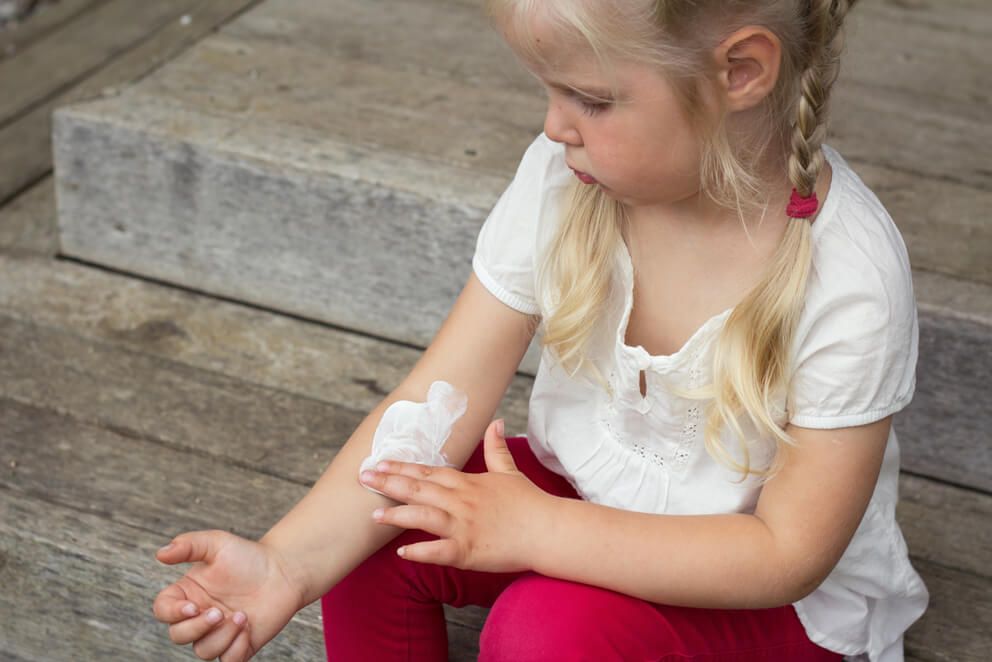 Атопический дерматит у детей. Правила ухода за кожей