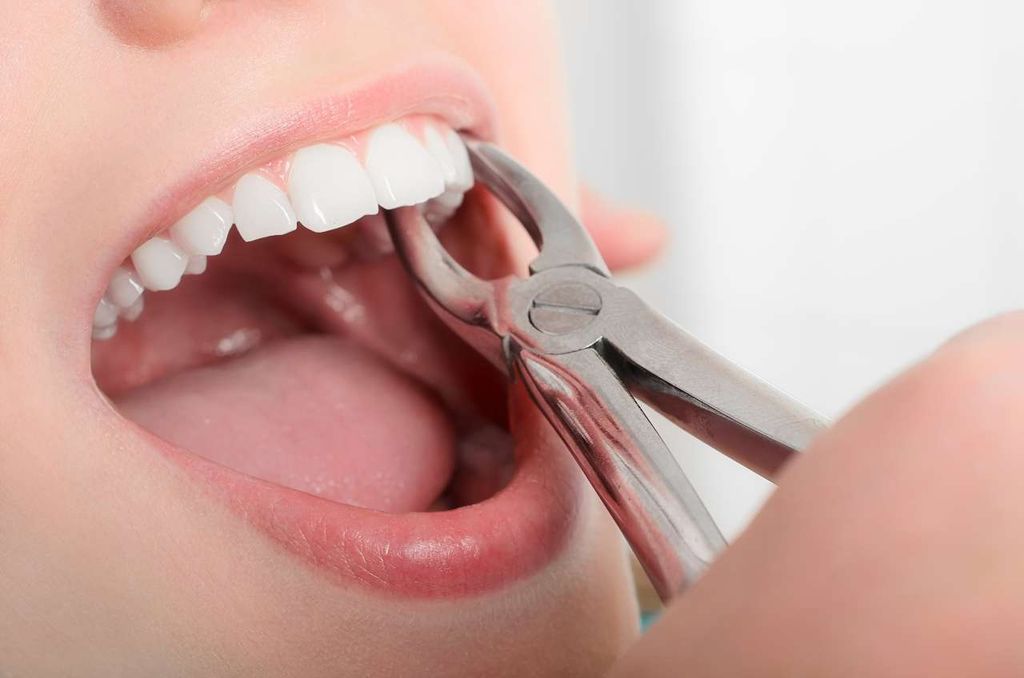 Удаление зуба томск стоматологии томск иркутский тракт